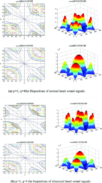 A) P = 5, Q = 4 The Bispectrum Of Normal Heart Sound Signals  (b