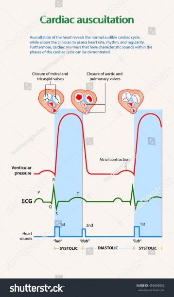 Image Heart Sounds How They Related Stock Vector (royalty Free