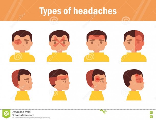 Illustration About Headaches 4 Type On Different Area Of Patient