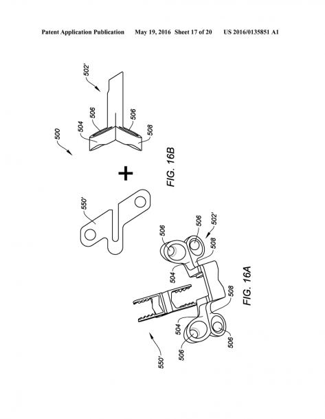 Interlaminar, Interspinous Stabilization Devices For The Cervical