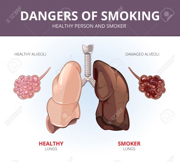 Lungs And Alveoli Of A Healthy Person And Smoker  Organ