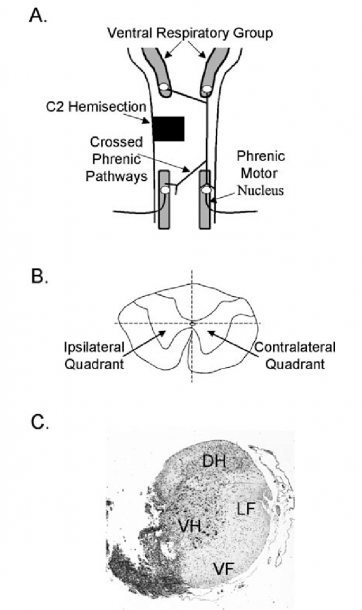 A) Diagram Of The Medulla And Cervical Spinal Cord Depicting The