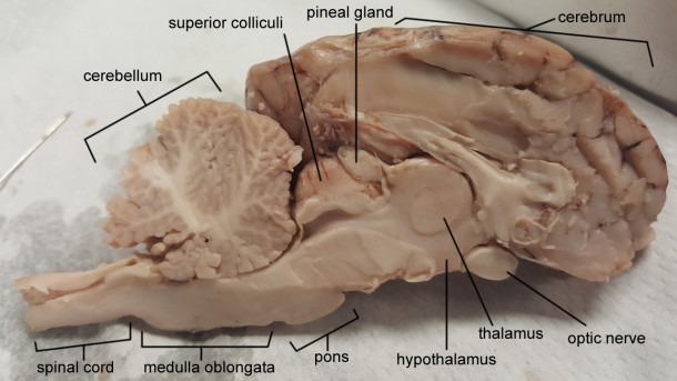 Brain Diagram Labeled Quiz