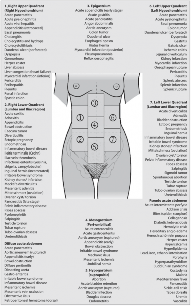 Differential Diagnosis Acute Abdominal Pain (adapted From Malbrain