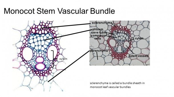 Diagram Of Vascular Bundle
