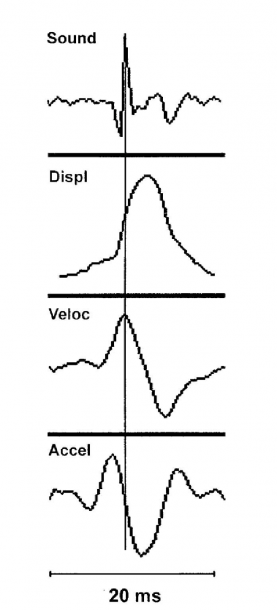 10  Peak Sound Energy Occurs In The Middle Of Displacement (muscle