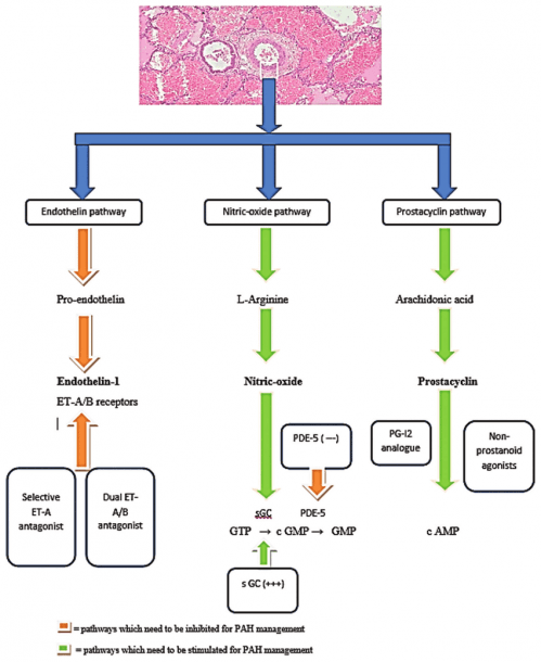 The Three Major Pathways Depicting The Pathophysiology Of The